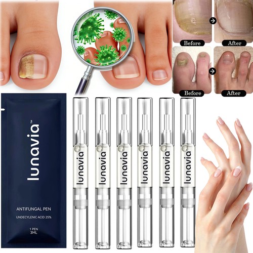 3pcs lunavia antifungal - 15/6/3pcs,